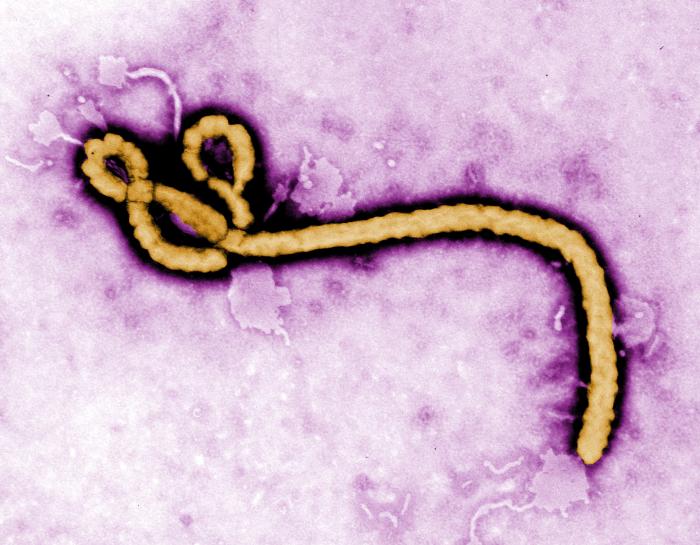 Close-up of Ebola virus